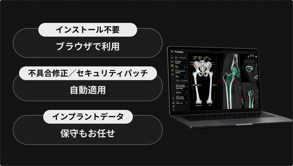 インストール不要でブラウザで利用、不具合修正やセキュリティパッチは自動適用、インプラントデータの保守もお任せ、を表した図